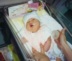 Alissa Nov. 2000 in the NICU