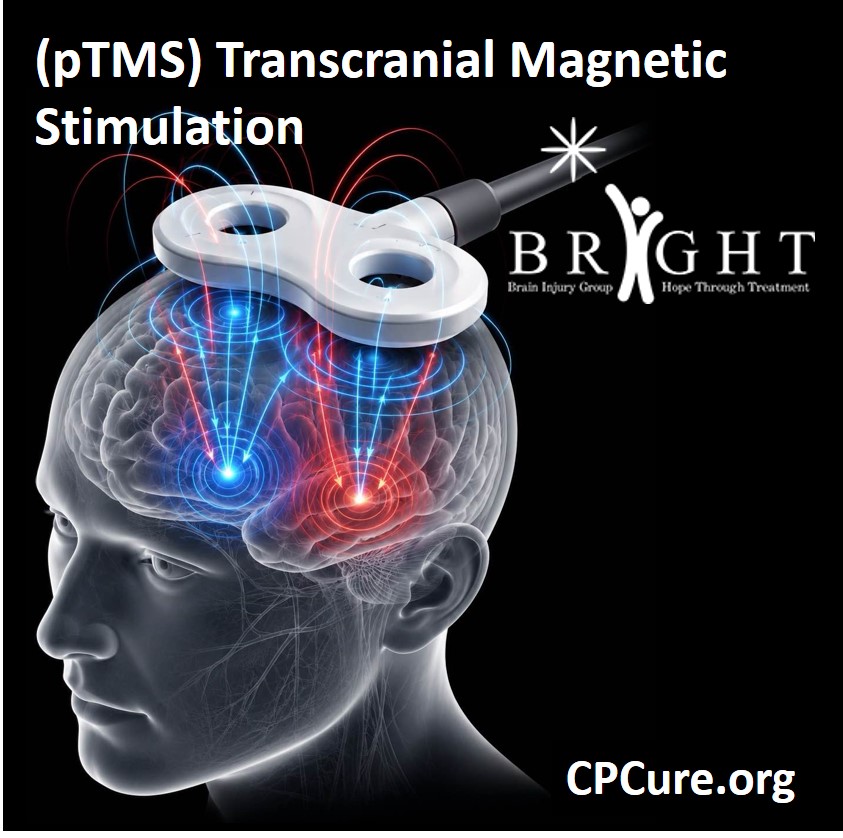 (pTMS) Transcranial Magnetic Stimulation